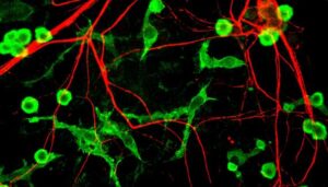 Microglia_and_neurons
